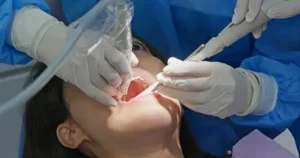 Dentist performing a root canal treatment on a patient using dental tools in a clinical setting.