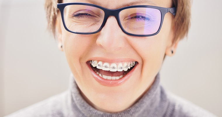 Woman in braces smiles