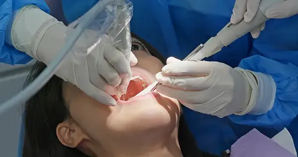 Read more about the article Root Canal Myths: Separating Fear from Fact