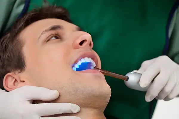 Read more about the article The Secret Weapon Against Cavities: Dental Sealants for Kids & Adults